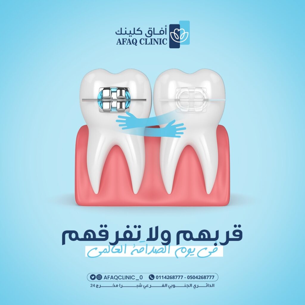 afaq 5 - فيوتشر فيجن
