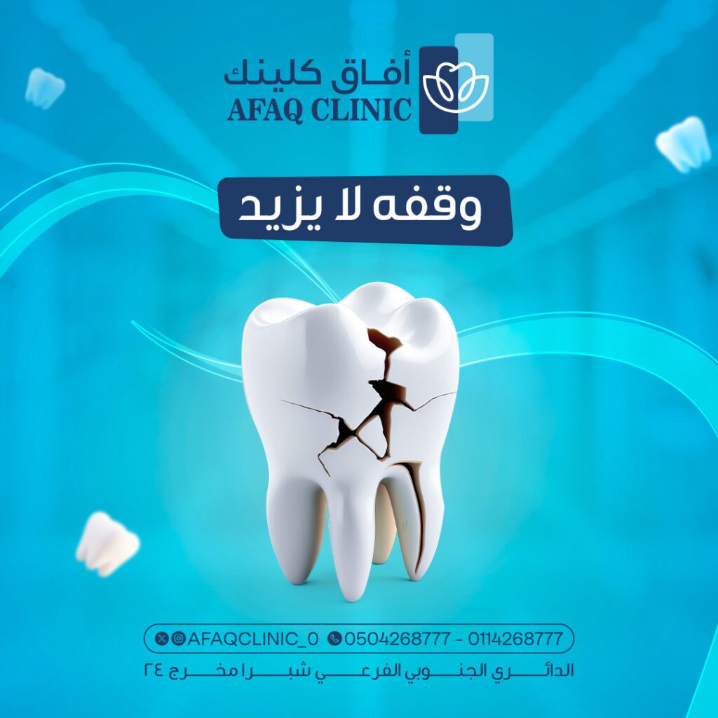afaq nov in 1————————————————————— - فيوتشر فيجن